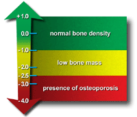 Bone Mineral Density (BMD / DEXA) - MMI Merivale Medical Imaging