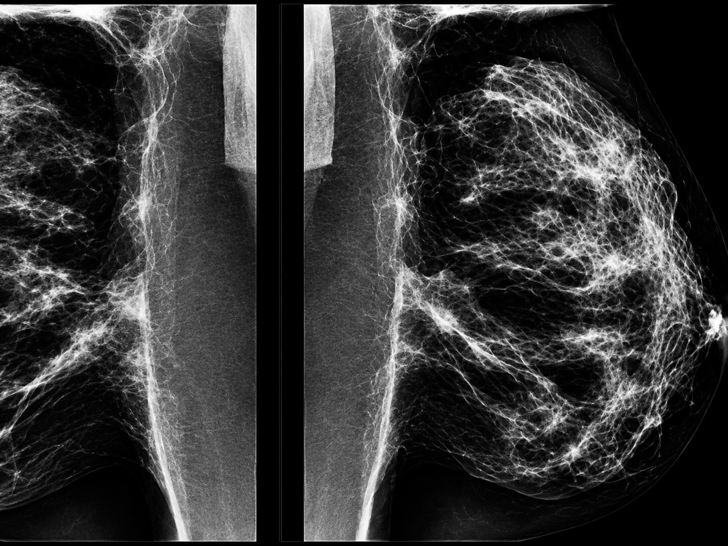 Mammography & OBSP at Merivale Medical Imaging